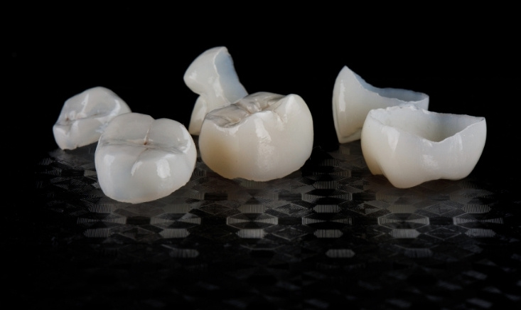 impact of dental crowns on oral health